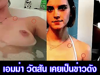 เอมม่า วัตสัน